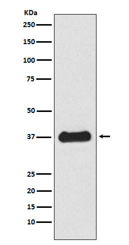 Follistatin Rabbit mAb ABZ5137