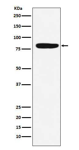 Factor XIIIa Rabbit mAb ABZ5140