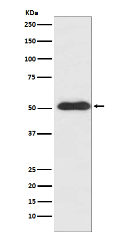 Slit2 Rabbit mAb ABZ5141