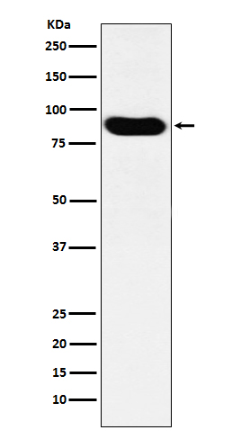 MCM7/PRL Rabbit mAb ABZ5144
