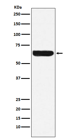 Placental Alkaline Phosphatase Rabbit mAb ABZ5145