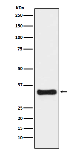 Thymidylate Synthase Rabbit mAb ABZ5147