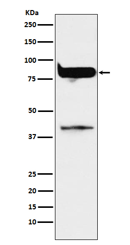 PKC eta Rabbit mAb ABZ5148