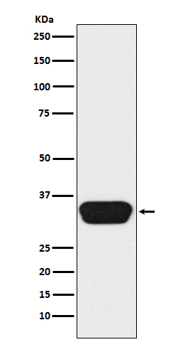 OTX1/2 Rabbit mAb ABZ5149