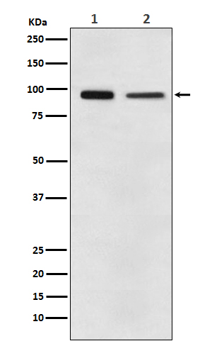EEF2/Elongation factor 2 Rabbit mAb ABZ5150
