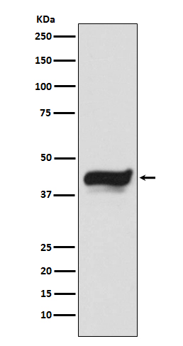 IKB epsilon Rabbit mAb ABZ5152