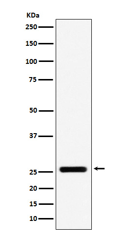 FADD Rabbit mAb ABZ5155