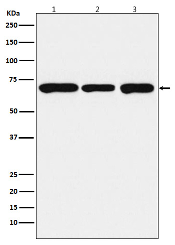 PCK2 Rabbit mAb ABZ5158
