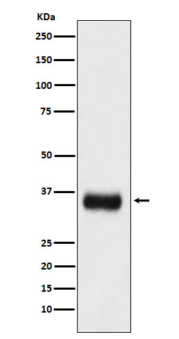 SF2 Rabbit mAb ABZ5161