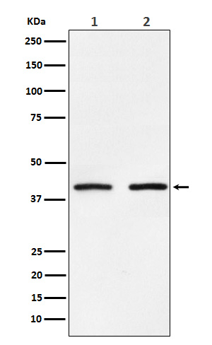 SMYD3 Rabbit mAb ABZ5163