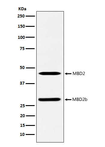 MBD2 Rabbit mAb ABZ5166