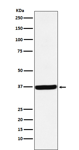 DDAH1 Rabbit mAb ABZ5167