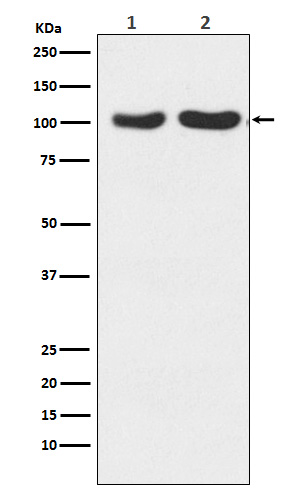Glutamate Receptor 2/3 Rabbit mAb ABZ5169