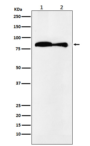 VPS35 Rabbit mAb ABZ5170