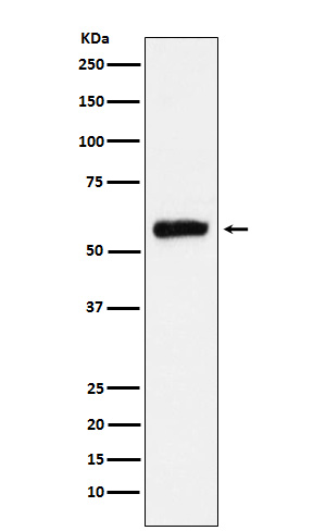 ALDH2 Rabbit mAb ABZ5171