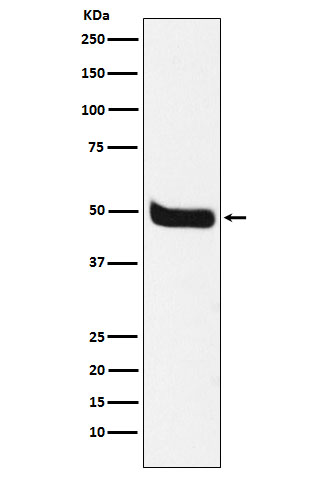 Neurokinin 1 Receptor Rabbit mAb ABZ5172