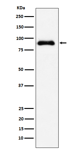 SATB2 Rabbit mAb ABZ5174