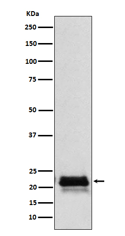 FSH beta Rabbit mAb ABZ5175