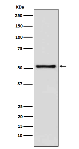 TdT Rabbit mAb ABZ5176