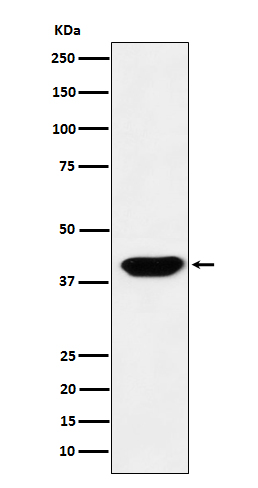 Islet 1 Rabbit mAb ABZ5177