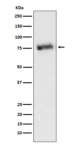 GRK3 Rabbit mAb ABZ5178
