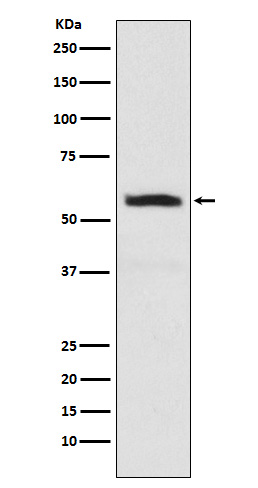 alpha Internexin Rabbit mAb ABZ5179