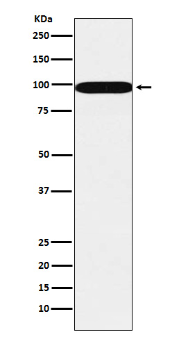 SFPQ Rabbit mAb ABZ5180