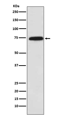 Cytochrome P450 Reductase Rabbit mAb ABZ5181