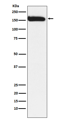 KAT13A/SRC1 Rabbit mAb ABZ5185