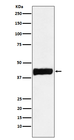 Creatine Kinase B type Rabbit mAb ABZ5186