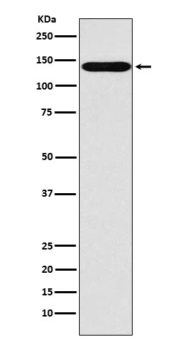 Sodium/Hydrogen Exchanger 1/NHE-1 Rabbit mAb ABZ5189