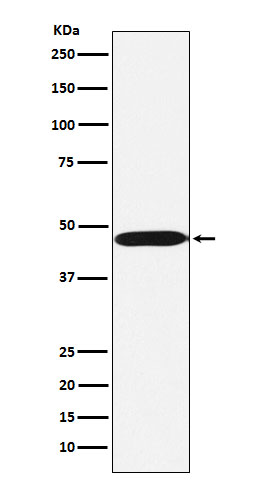 ACTL6A Rabbit mAb ABZ5191