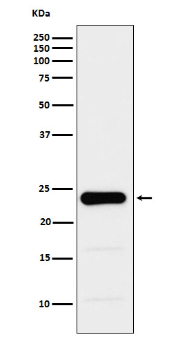 GST3 / GST pi Rabbit mAb ABZ5195