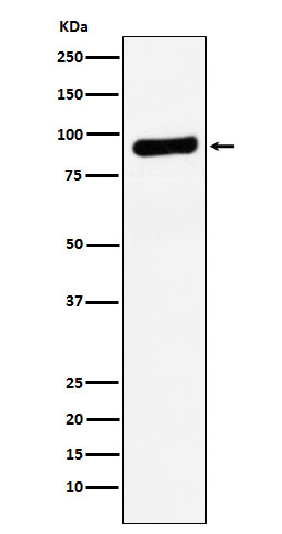RRM1 Rabbit mAb ABZ5196