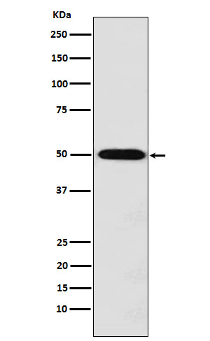 Monocarboxylic Acid Transporter 1 Rabbit mAb ABZ5197