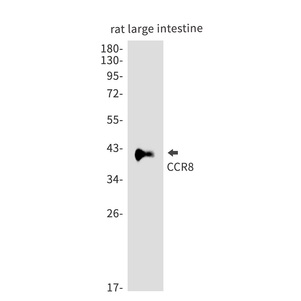 CCR8 Rabbit mAb ABZ5201