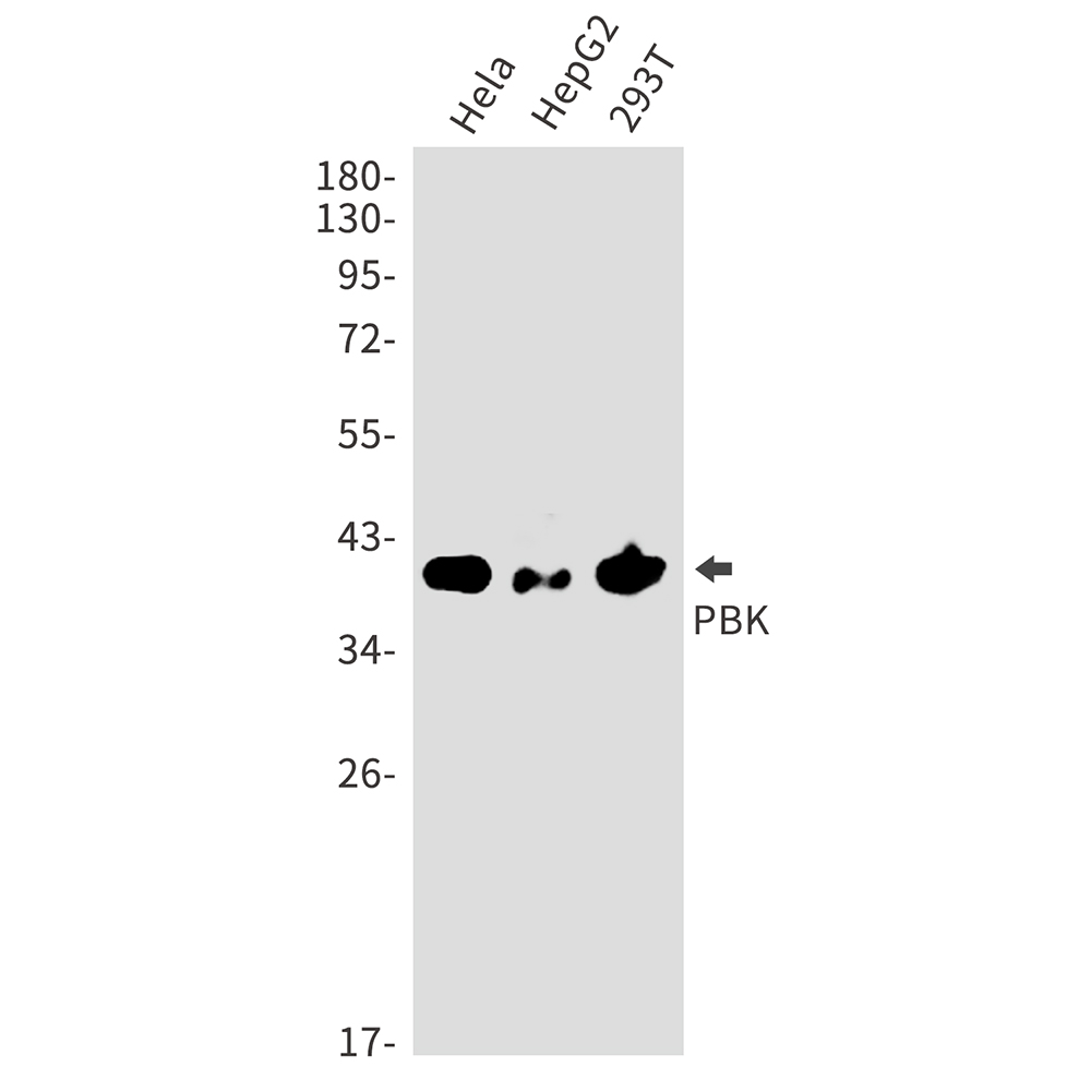 PBK Rabbit mAb ABZ5204