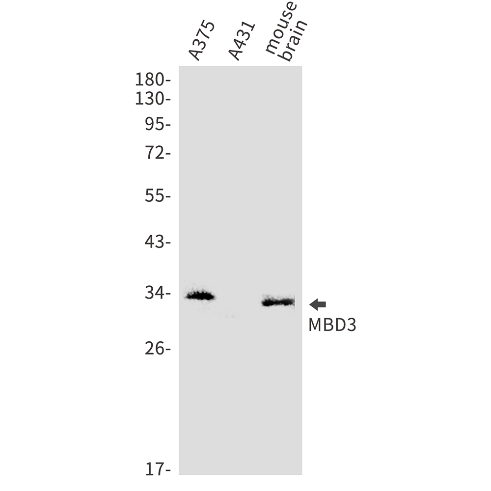 MDB3 Rabbit mAb ABZ5208