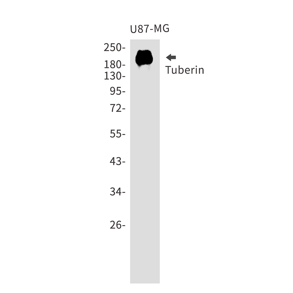 Tuberin Rabbit mAb ABZ5209