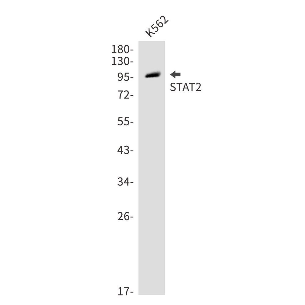 STAT2 Rabbit mAb ABZ5210