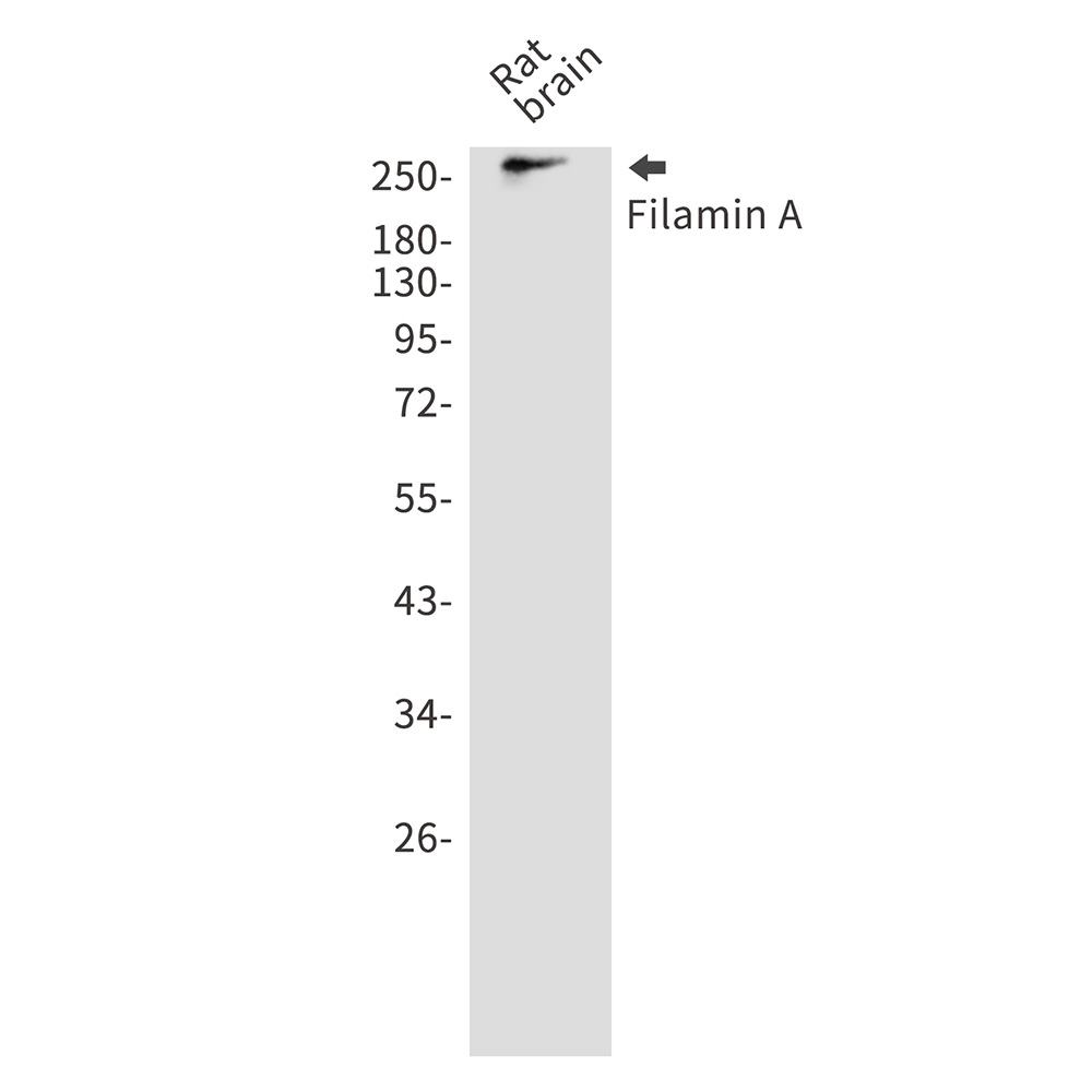 Filamin A Rabbit mAb ABZ5211