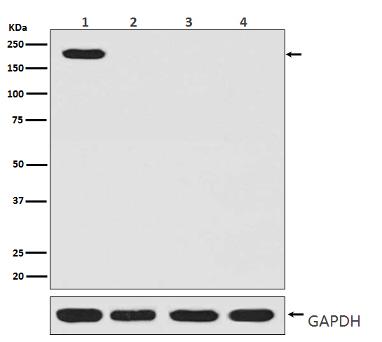 CRISPR Cas9 SP Rabbit mAb ABZ5216