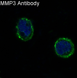 MMP3 Rabbit mAb ABZ5218