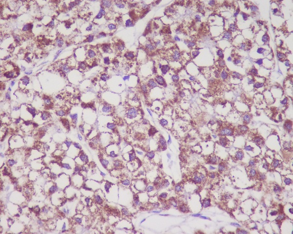 MMP3 Rabbit mAb ABZ5218