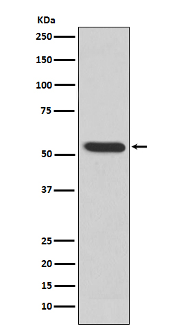 MMP3 Rabbit mAb ABZ5218