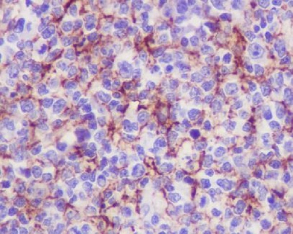 VCAM1 Rabbit mAb ABZ5219