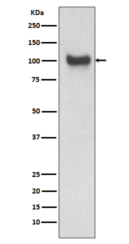 VCAM1 Rabbit mAb ABZ5219