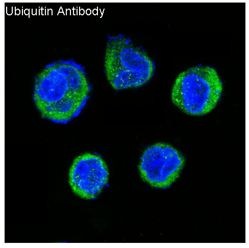 Ubiquitin Rabbit mAb ABZ5220