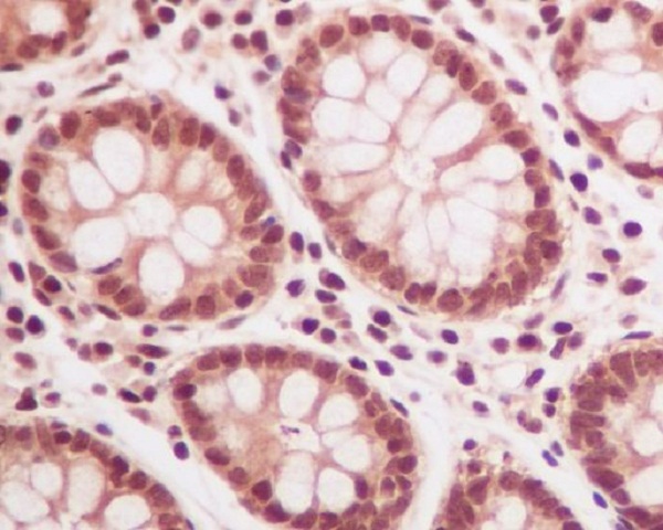 Ubiquitin Rabbit mAb ABZ5220