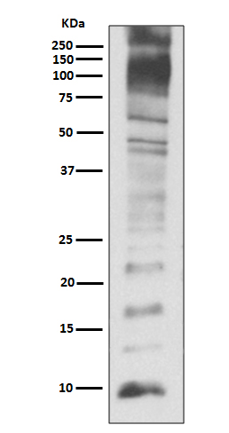 Ubiquitin Rabbit mAb ABZ5220